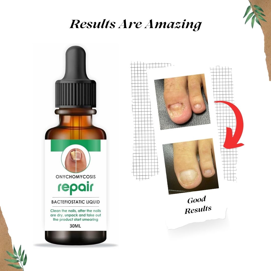 Nail Repair Serum (š¢Buy 1 Get 1 FREE)