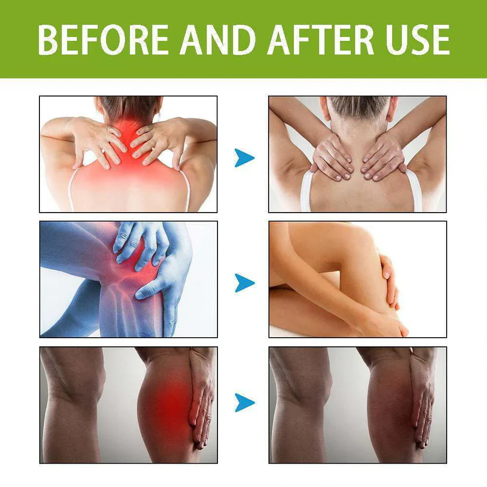 Bee Venom Joint and Bone Therapy Creamš (Buy 1 Get 2 Free)