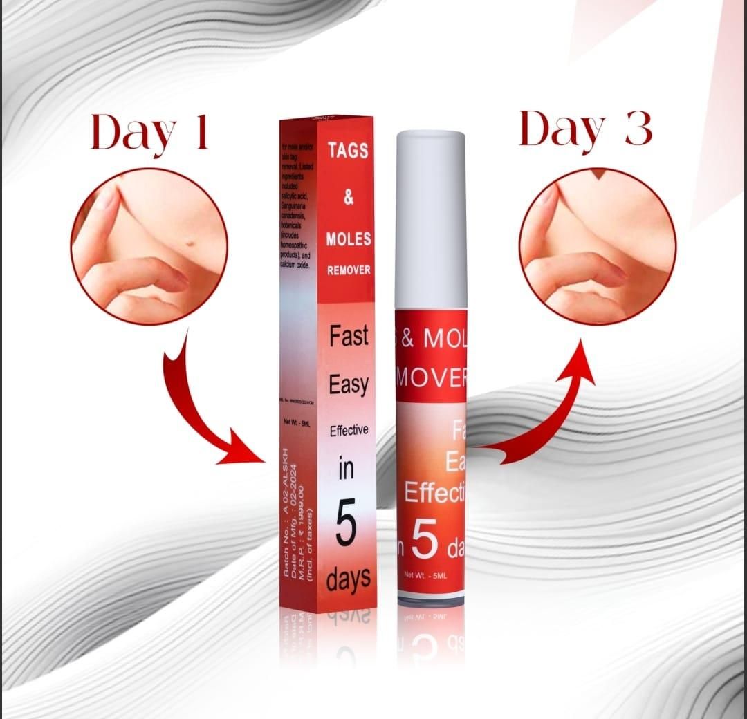 Tags & Moles Remover (Buy 1 Get 1 Free )