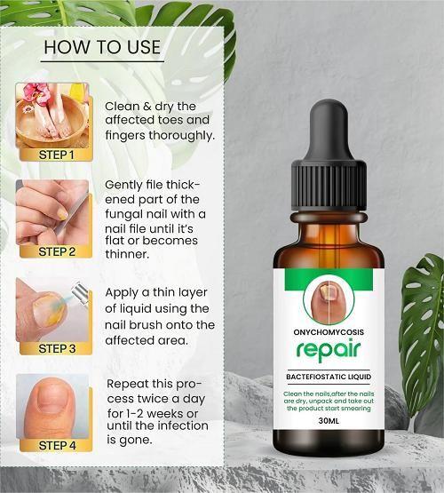 Nail Repair Serum (š¢Buy 1 Get 1 FREE)