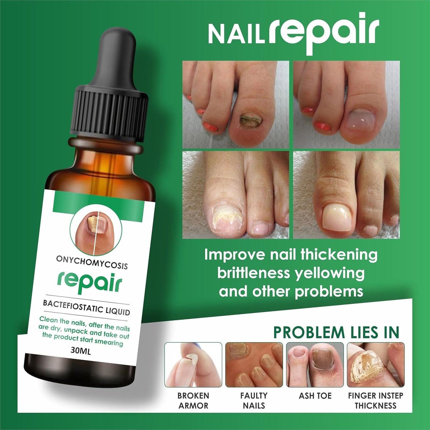Nail Repair Serum (š¢Buy 1 Get 1 FREE)