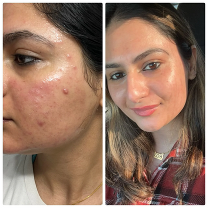 Korean Collagen Peel Off Mask (Buy 1 Get 1 Free)