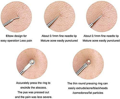 Stainless Steel Blackhead Remover Extractor Tool