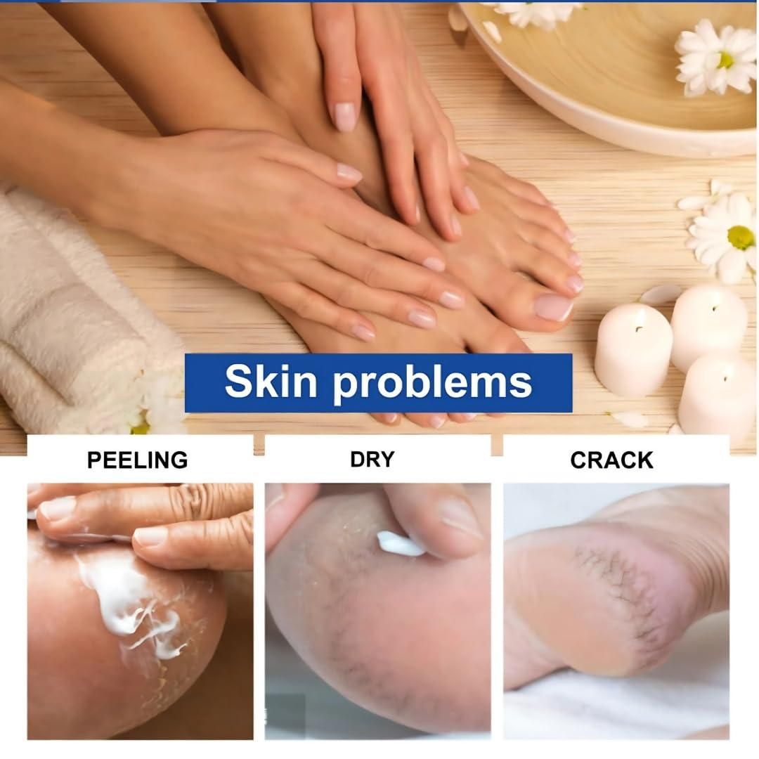 Foot & Fingers Revive Cream (Buy 1 Get 1 Free)