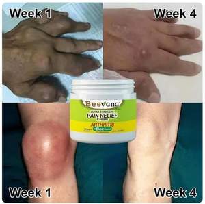 Bee Venom Joint and Bone Therapy Cream🐝 (Buy 1 Get 2 Free)