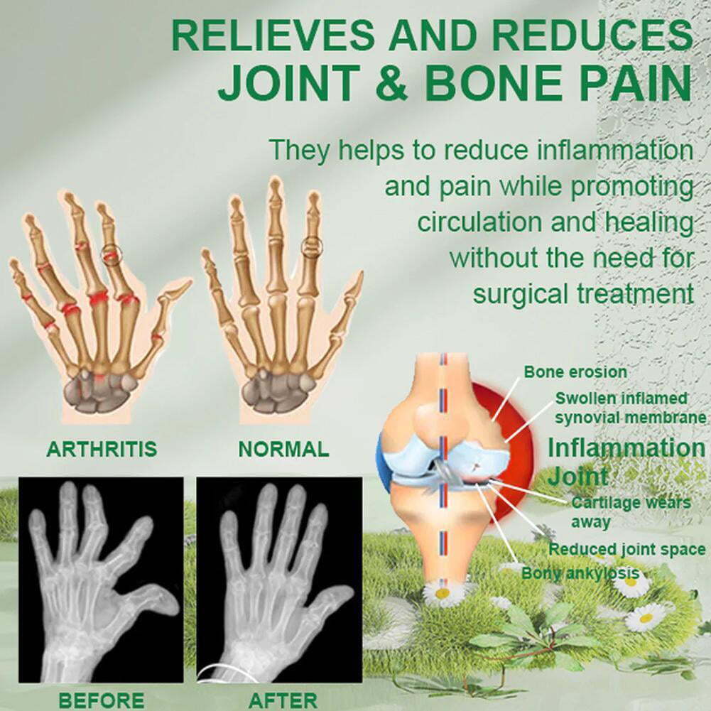 Bee Venom Joint and Bone Therapy Cream🐝 (Buy 1 Get 2 Free)