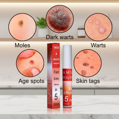 Tags & Moles Remover (🔥Buy 1 Get 1 Free🔥)