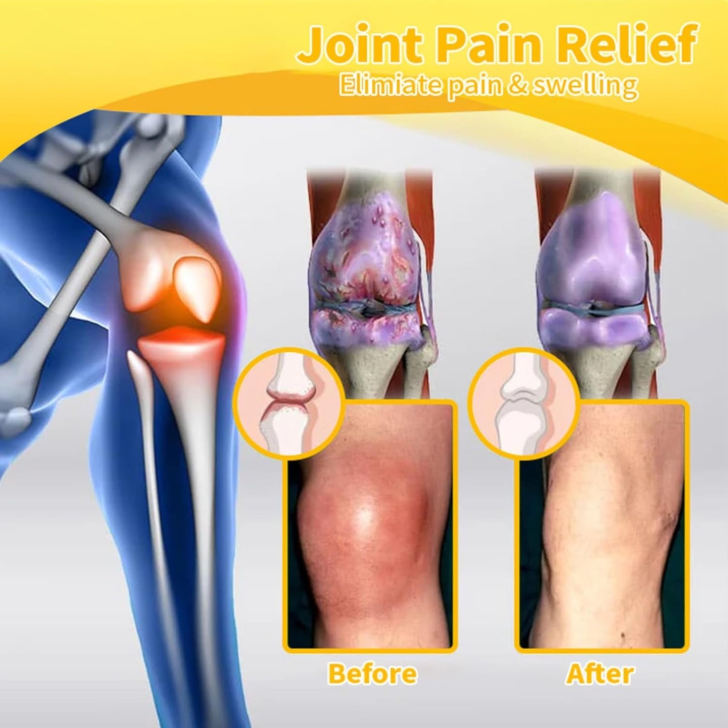 Arthrofree™ - Bee-Venom Pain-Relief Cream 🐝(Buy 1 Get 1 Free)