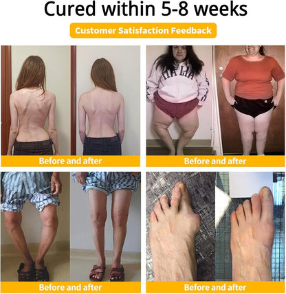 Arthrofree™ - Bee-Venom Pain-Relief Cream 🐝(Buy 1 Get 1 Free)